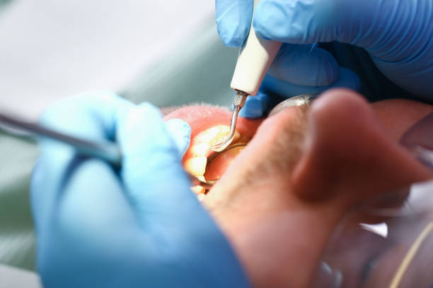 Best Urgent Care for Lost Fillings or Crowns in Park City, KS