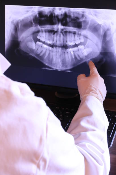 Best Emergency Treatment for Dental Infections or Abscesses in Park City, KS