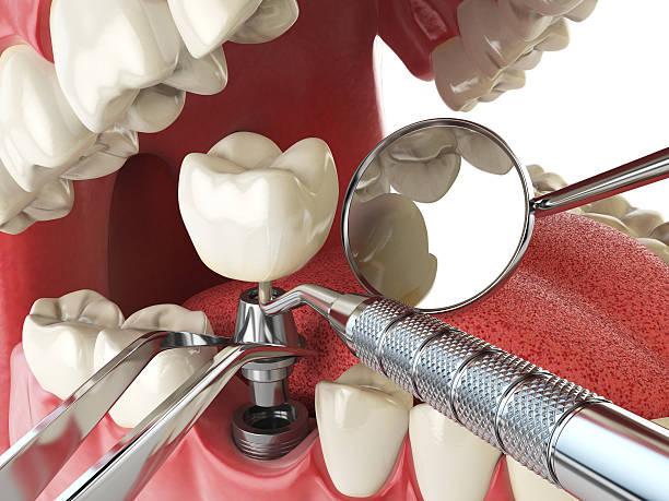 Best Emergency Denture Repair in Park City, KS